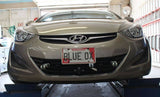 BASEPLATE 2016 ELANTRA GT